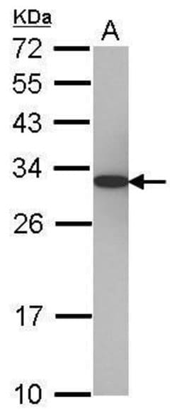 Invitrogen PSME1 Polyclonal Antibody 100 &mu;L; Unconjugated:Antibodies,