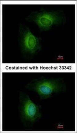 Invitrogen CYP1B1 Polyclonal Antibody 100 &mu;L | Buy Online | Invitrogen&trade; | Fisher Scientific