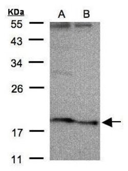 Invitrogen SCN3B Polyclonal Antibody 100 &mu;L; Unconjugated:Antibodies,