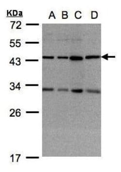 Invitrogen DNAJC17 Polyclonal Antibody 100 &mu;L; Unconjugated:Antibodies,