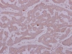 Invitrogen PCYT2 Polyclonal Antibody 100 &mu;L; Unconjugated:Antibodies,