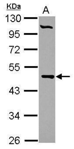 Invitrogen PCYT2 Polyclonal Antibody 100 &mu;L; Unconjugated:Antibodies,