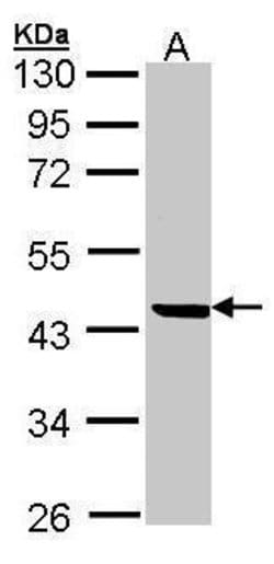 Invitrogen SERPINB1 Polyclonal Antibody 100 &mu;L; Unconjugated:Antibodies,