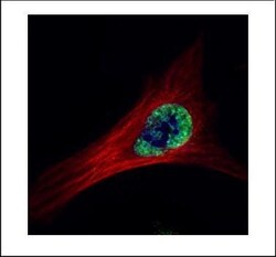Invitrogen ETS2 Polyclonal Antibody 100 &mu;L; Unconjugated:Antibodies,