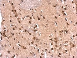 Invitrogen ETS2 Polyclonal Antibody 100 &mu;L; Unconjugated:Antibodies,