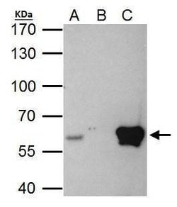 Invitrogen ETS2 Polyclonal Antibody 100 &mu;L; Unconjugated:Antibodies,