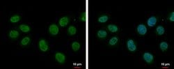 Invitrogen SF1 Polyclonal Antibody 100 &mu;L; Unconjugated:Antibodies,