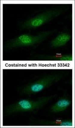Invitrogen IFRD1 Polyclonal Antibody 100 &mu;L; Unconjugated:Antibodies,