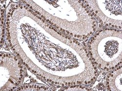 Invitrogen FUBP1 Polyclonal Antibody 100 &mu;L; Unconjugated:Antibodies,