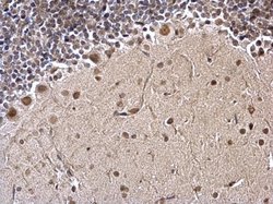 Invitrogen FUBP1 Polyclonal Antibody 100 &mu;L; Unconjugated:Antibodies,