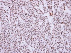 Invitrogen RCC1 Polyclonal Antibody 100 &mu;L; Unconjugated:Antibodies,