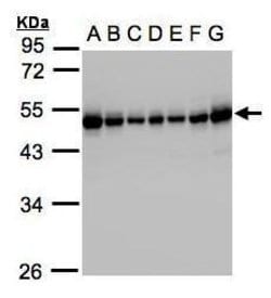 Invitrogen RCC1 Polyclonal Antibody 100 &mu;L; Unconjugated:Antibodies,