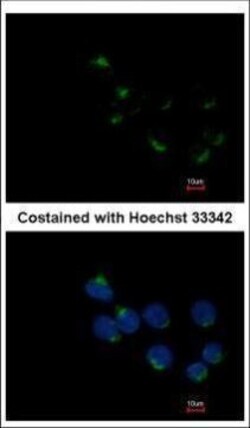 Invitrogen GALNT6 Polyclonal Antibody 100 &mu;L | Buy Online | Invitrogen&trade; | Fisher Scientific