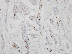 Invitrogen GALNT6 Polyclonal Antibody 100 &mu;L; Unconjugated:Antibodies,