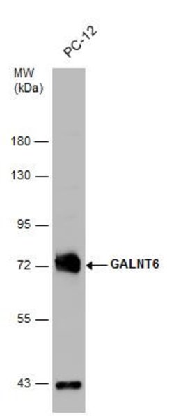 Invitrogen GALNT6 Polyclonal Antibody 100 &mu;L; Unconjugated:Antibodies,