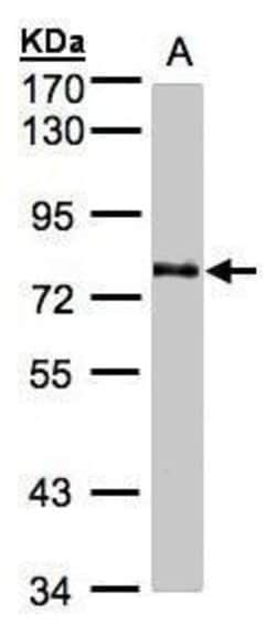 Invitrogen GALNT6 Polyclonal Antibody 100 &mu;L; Unconjugated:Antibodies,