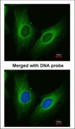 Invitrogen AKR1C3 Polyclonal Antibody 100 &mu;L | Buy Online | Invitrogen&trade; | Fisher Scientific