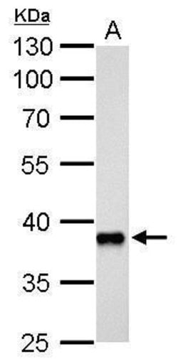 Invitrogen AKR1C3 Polyclonal Antibody 100 &mu;L | Buy Online | Invitrogen&trade; | Fisher Scientific