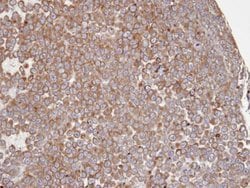 Invitrogen COX1 Polyclonal Antibody 100 &mu;L | Buy Online | Invitrogen&trade; | Fisher Scientific