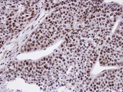 Invitrogen FCP1 Polyclonal Antibody 100 &mu;L; Unconjugated:Antibodies,