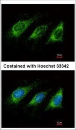 Invitrogen AID Polyclonal Antibody 100 &mu;L; Unconjugated:Antibodies,