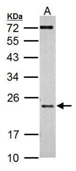 Invitrogen AID Polyclonal Antibody 100 &mu;L; Unconjugated:Antibodies,