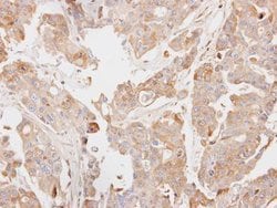Invitrogen PCK2 Polyclonal Antibody 100 &mu;L | Buy Online | Invitrogen&trade; | Fisher Scientific