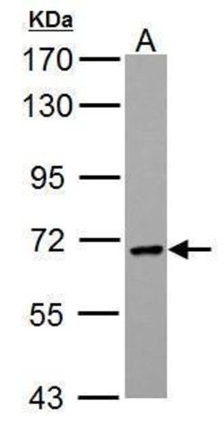 Invitrogen PCK2 Polyclonal Antibody 100 &mu;L | Buy Online | Invitrogen&trade; | Fisher Scientific