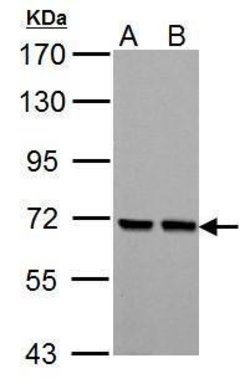 Invitrogen PCK2 Polyclonal Antibody 100 &mu;L | Buy Online | Invitrogen&trade; | Fisher Scientific
