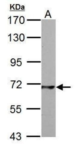 Invitrogen PCK2 Polyclonal Antibody 100 &mu;L | Buy Online | Invitrogen&trade; | Fisher Scientific