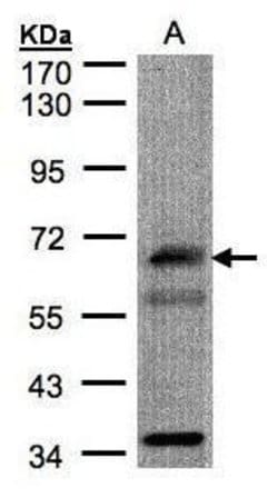 Invitrogen CHFR Polyclonal Antibody 100 &mu;L; Unconjugated:Antibodies,