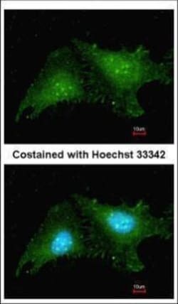 Invitrogen RNF25 Polyclonal Antibody 100 &mu;L; Unconjugated:Antibodies,
