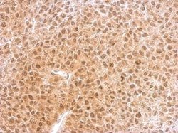 Invitrogen RNF25 Polyclonal Antibody 100 &mu;L; Unconjugated:Antibodies,