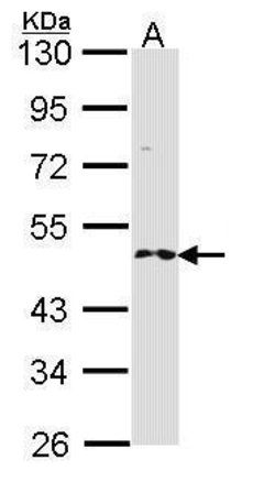 Invitrogen RNF25 Polyclonal Antibody 100 &mu;L; Unconjugated:Antibodies,