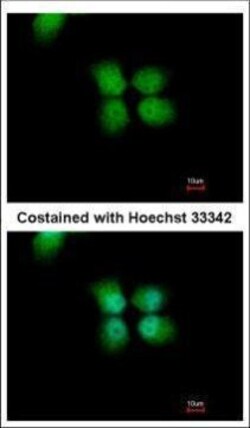 Invitrogen ORC4 Polyclonal Antibody 100 &mu;L; Unconjugated:Antibodies,