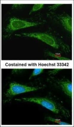 Invitrogen Cyclophilin A Polyclonal Antibody 100 &mu;L; Unconjugated:Antibodies,
