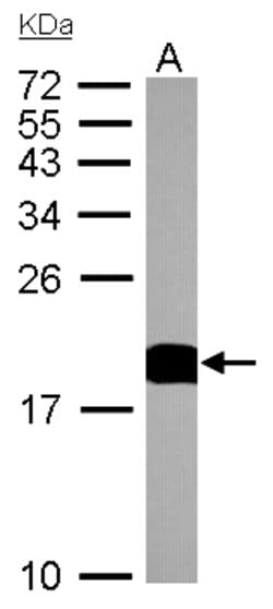 Invitrogen Cyclophilin A Polyclonal Antibody 100 &mu;L; Unconjugated:Antibodies,