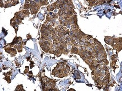 Invitrogen Stathmin 1 Polyclonal Antibody 100 &mu;L; Unconjugated:Antibodies,