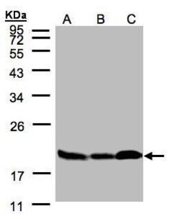 Invitrogen Stathmin 1 Polyclonal Antibody 100 &mu;L; Unconjugated:Antibodies,