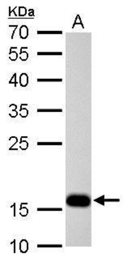 Invitrogen Stathmin 1 Polyclonal Antibody 100 &mu;L; Unconjugated:Antibodies,