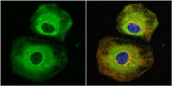 Invitrogen Stathmin 1 Polyclonal Antibody 100 &mu;L; Unconjugated:Antibodies,