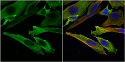 Invitrogen Stathmin 1 Polyclonal Antibody 100 &mu;L; Unconjugated:Antibodies,