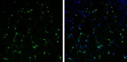 Invitrogen Stathmin 1 Polyclonal Antibody 100 &mu;L; Unconjugated:Antibodies,