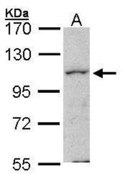 Invitrogen HPK1 Polyclonal Antibody 100 &mu;L | Buy Online | Invitrogen&trade; | Fisher Scientific