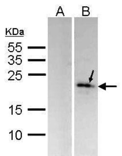 Invitrogen DUSP14 Polyclonal Antibody 100 &mu;L; Unconjugated:Antibodies,
