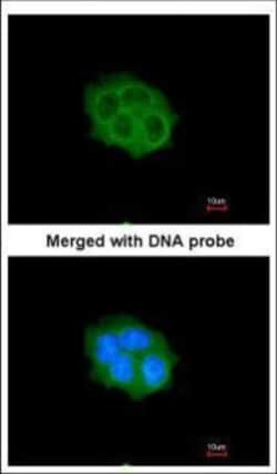 Invitrogen SPHK1 Polyclonal Antibody 100 &mu;L; Unconjugated:Antibodies,