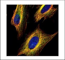 Invitrogen VDAC2 Polyclonal Antibody 100 &mu;L; Unconjugated:Antibodies,