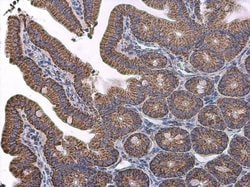 Invitrogen VDAC2 Polyclonal Antibody 100 &mu;L; Unconjugated:Antibodies,