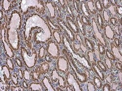 Invitrogen VDAC2 Polyclonal Antibody 100 &mu;L; Unconjugated:Antibodies,