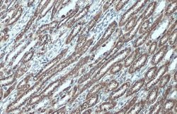 Invitrogen VDAC2 Polyclonal Antibody 100 &mu;L; Unconjugated:Antibodies,